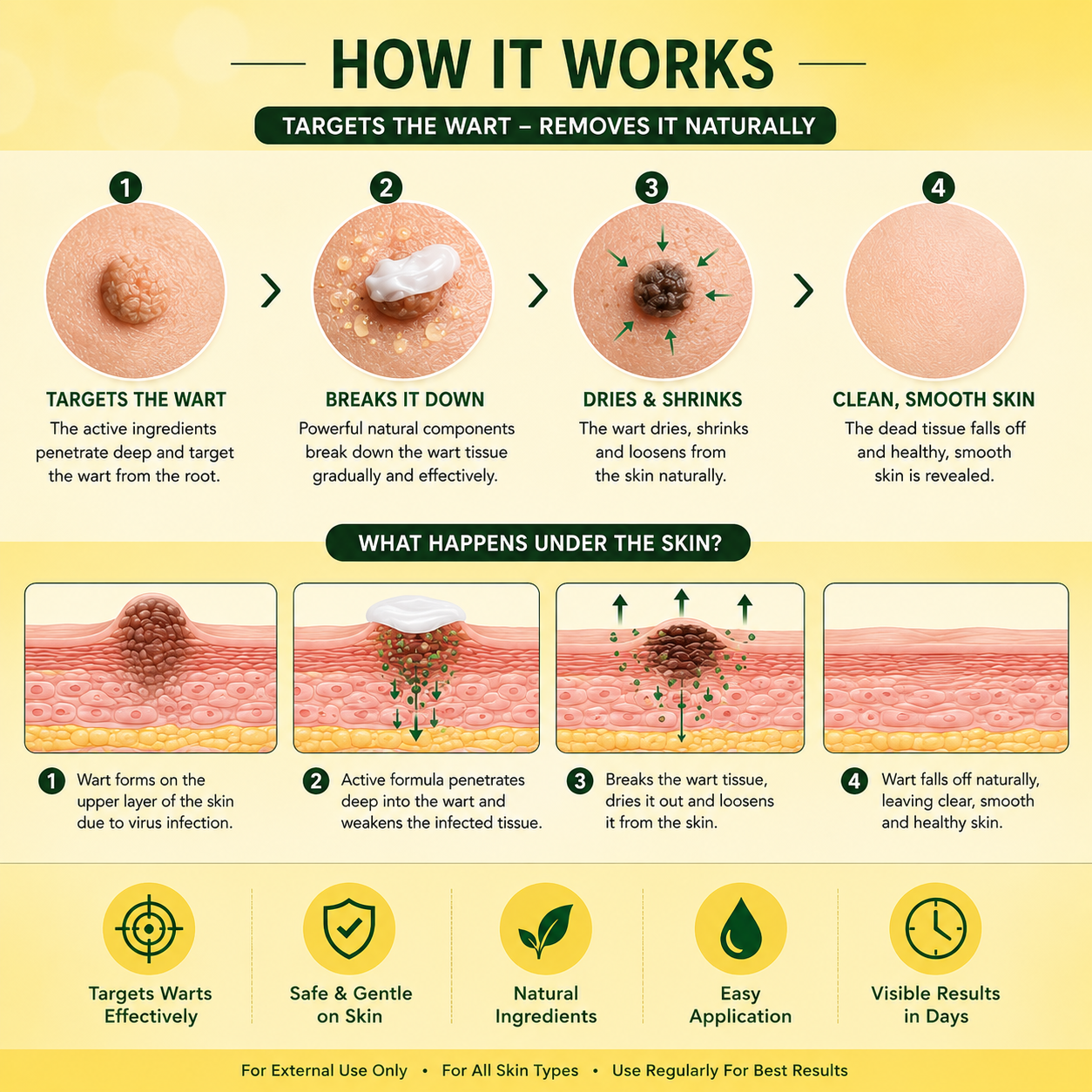 Safe Warts Remover Cream (15ml)