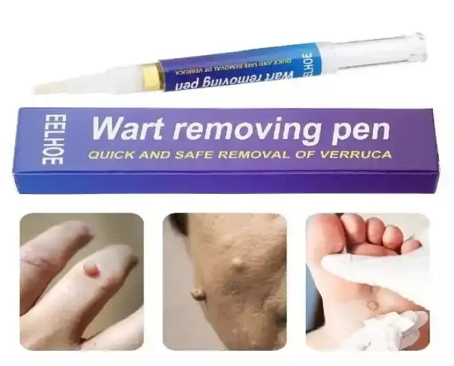 Eelhoe Wart Removing Pen